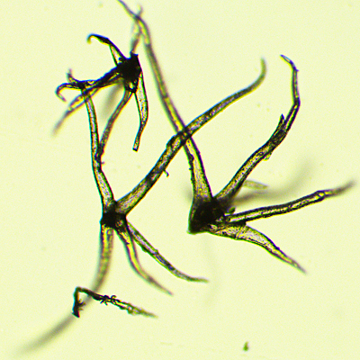 Black Oak Leaf - Stellate  hairs - compound microscope