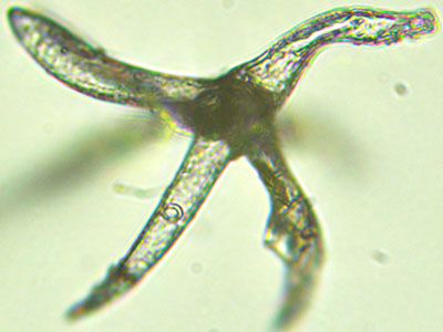 Black Oak Leaf - Stellate  hairs compound microscope